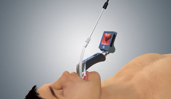 Laringoscópio de 5 Mac Miller Blades Medical Digital Video com a pata ergonômica da mão