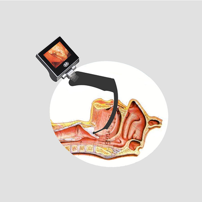Conjunto de laringoscópio médico rígido LCD de visão geral de 360 ​​graus com bateria recarregável