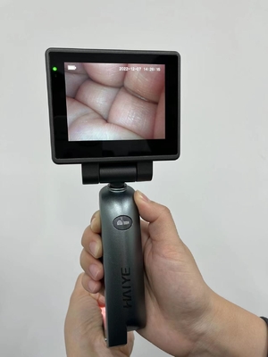 3,0 laringoscópio video médico da exposição da polegada HD - laringoscópio video da intubação