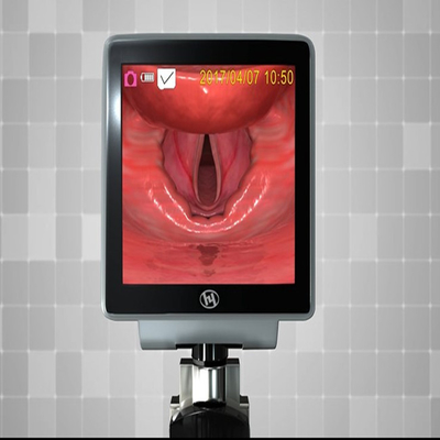 Cartão do SD laringoscópio video da lâmina descartável do dispositivo médico de uma emergência de 32 GB