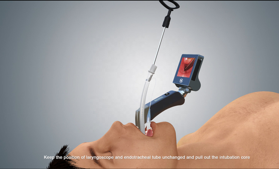 laringoscópio cirúrgico de 100mm Endoscopevideo com lâminas reusáveis