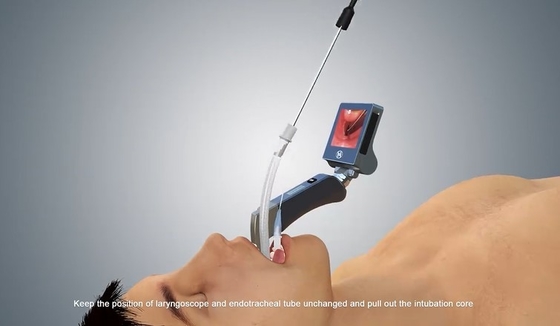Anti equipamento video médico microbiano do laringoscópio para a pediatria 1280 x pixel 720